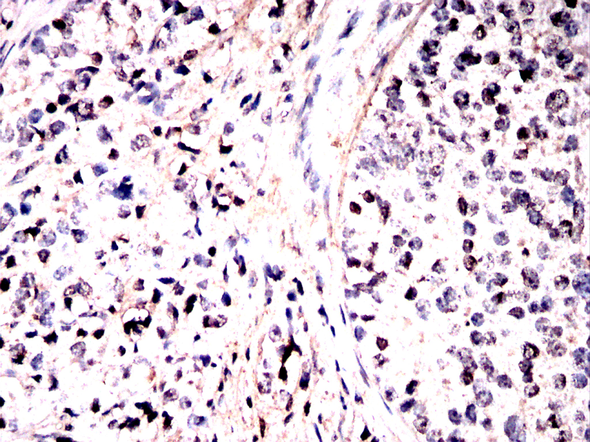                          IHC